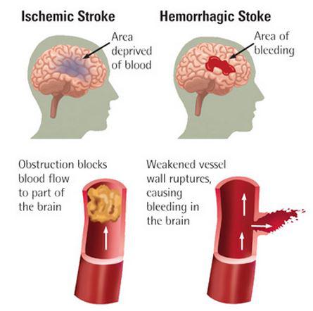 Seems natural remedies for improving concentration the mind destroyed Natural remedies for improving concentration image 16